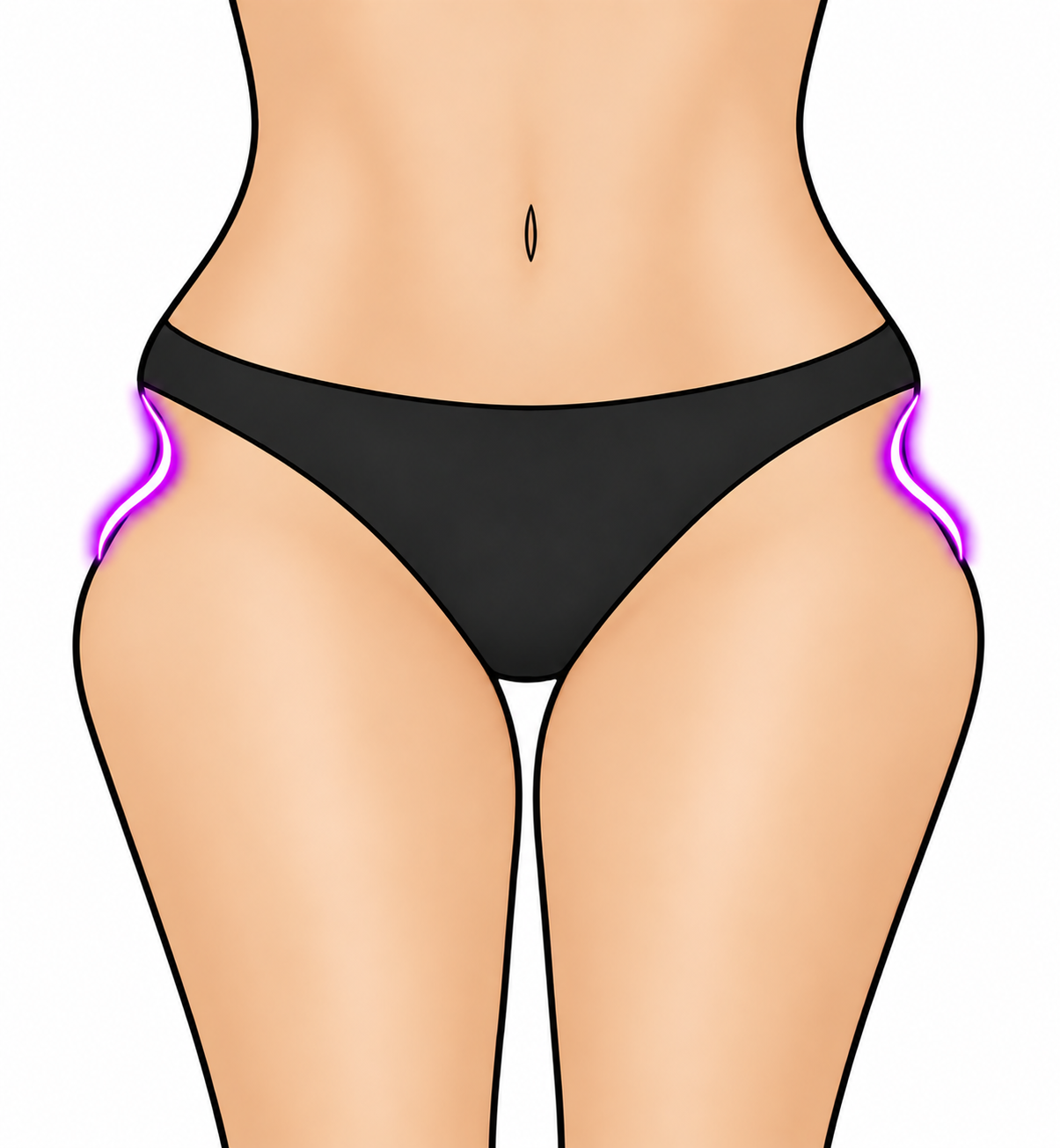 Severe hip dips